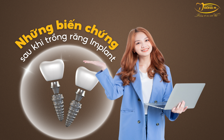 trong-rang-implant