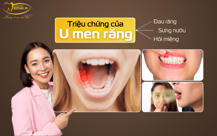 tinh-trang-u-men-rang