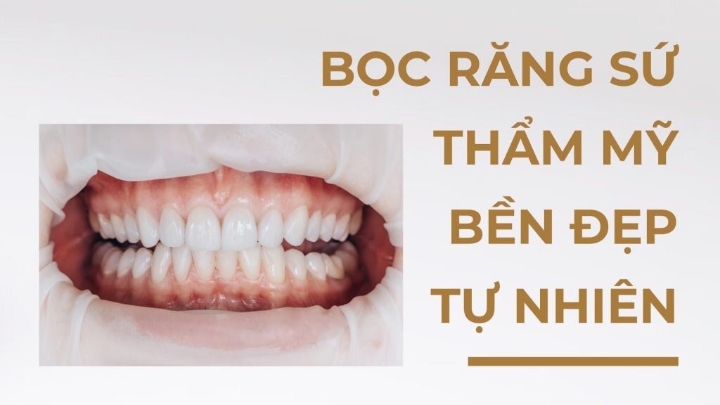Boc Rang Su Co Ben Khong