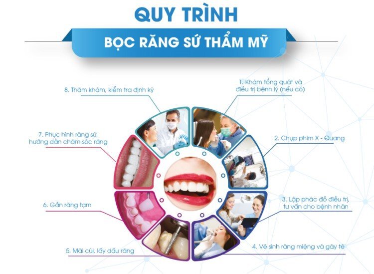 Quy Trinh