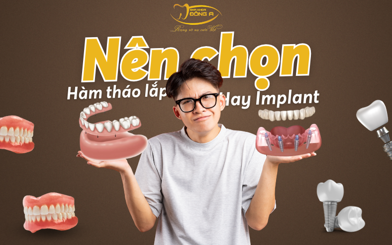 ham-thao-lap-hay-implant
