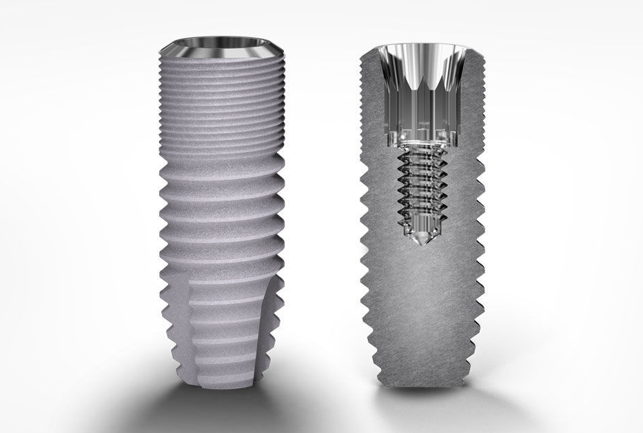 Chất lượng trụ Implant