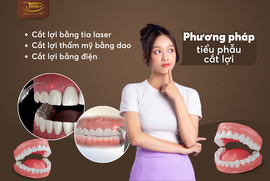 cat-ho-loi