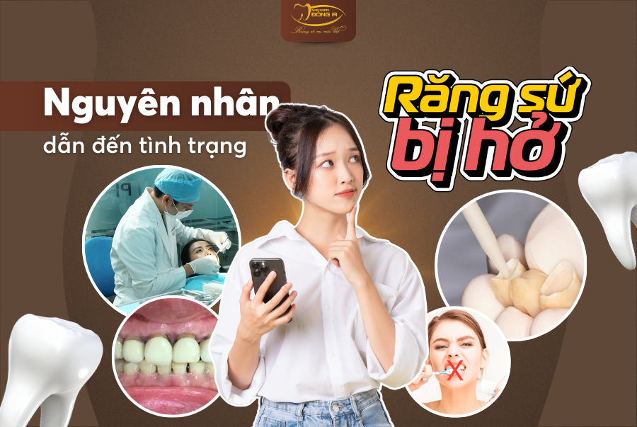 rang-su-bi-ho