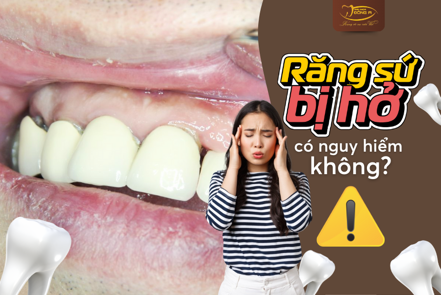 rang-su-bi-ho