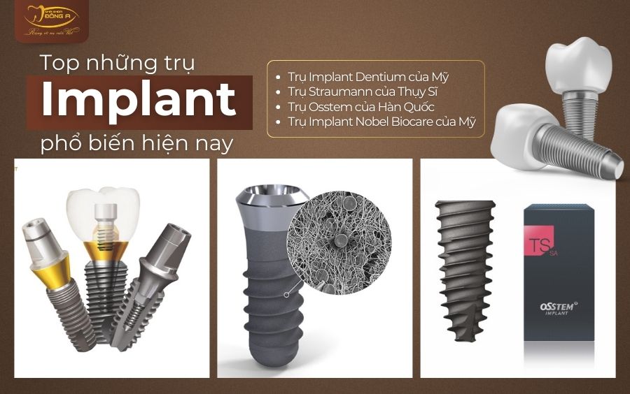 Tru-Implant-pho-bien-hien-nay