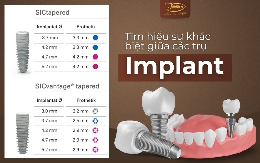 Tru-Implant-pho-bien-hien-nay