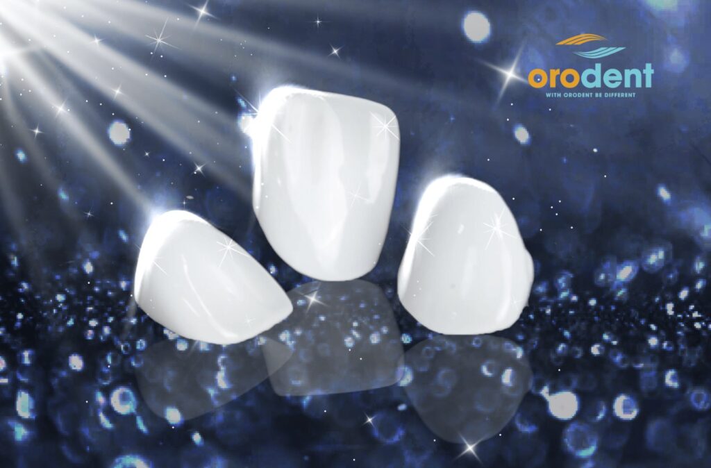 Răng sứ Orodent là gì?
