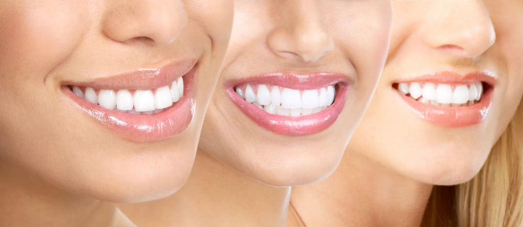 Địa chỉ bọc sứ HT Smile uy tín tại HCM