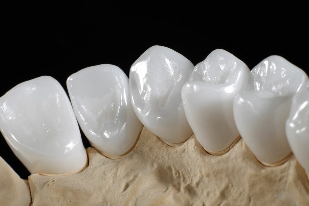 Răng sứ HT Smile đáp ứng tiêu chuẩn chất lượng