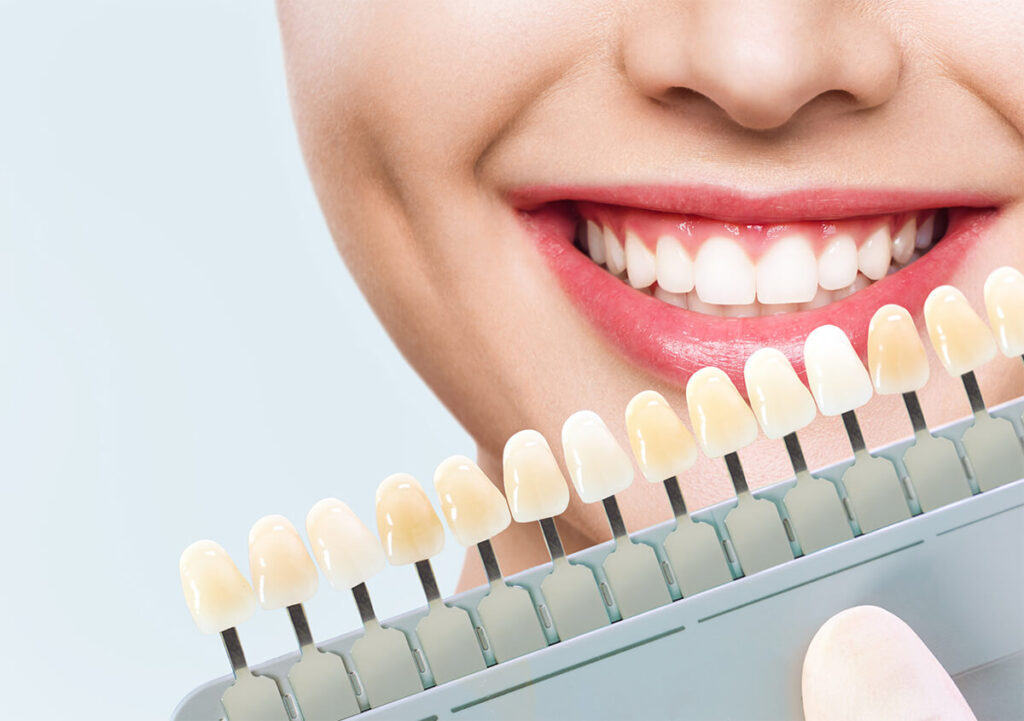 Sứ Nacera có độ bền màu cao