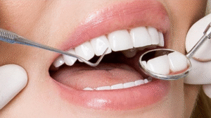 Vì sao chăm sóc răng sứ sau khi bọc lại quan trọng? 