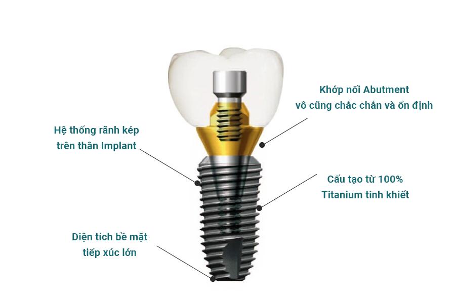 Cấu tạo của trụ Implant Dentium Mỹ